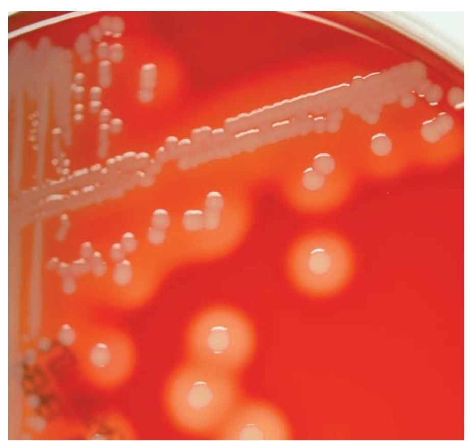 <p>Yellow graycolonies w/clear zone of hemolysis</p>