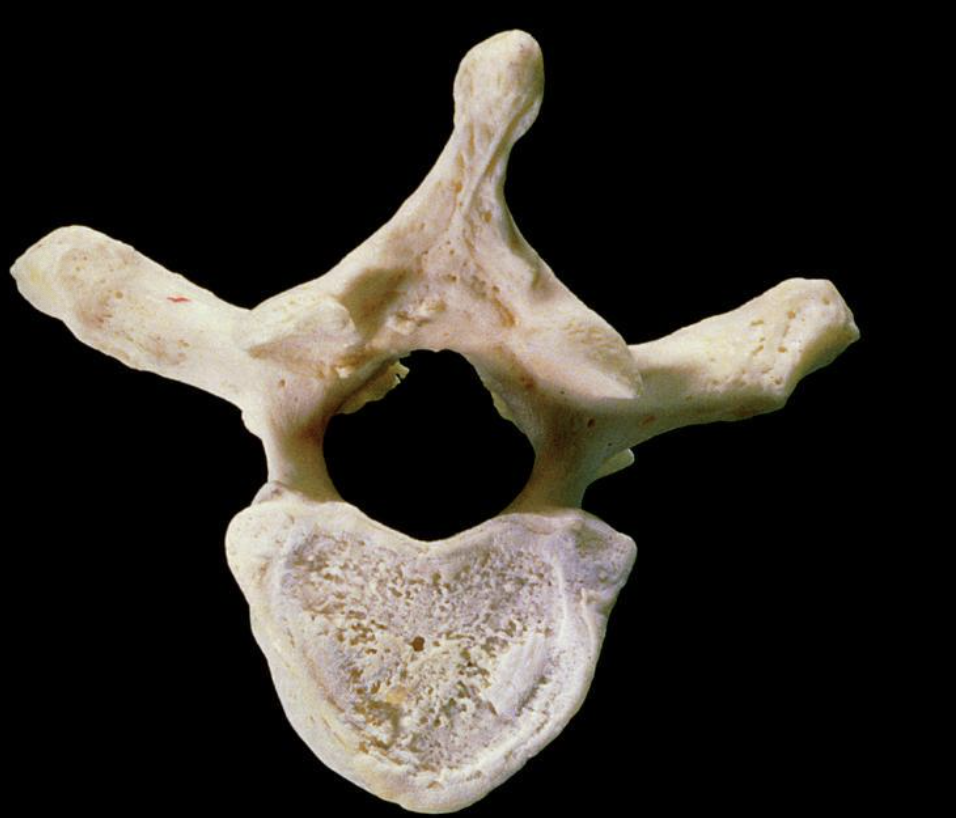 <p>What is this? In an adult there are black vertebrae. What do those columns do?  </p>