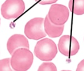 <p>what type of blood cell is this?</p>