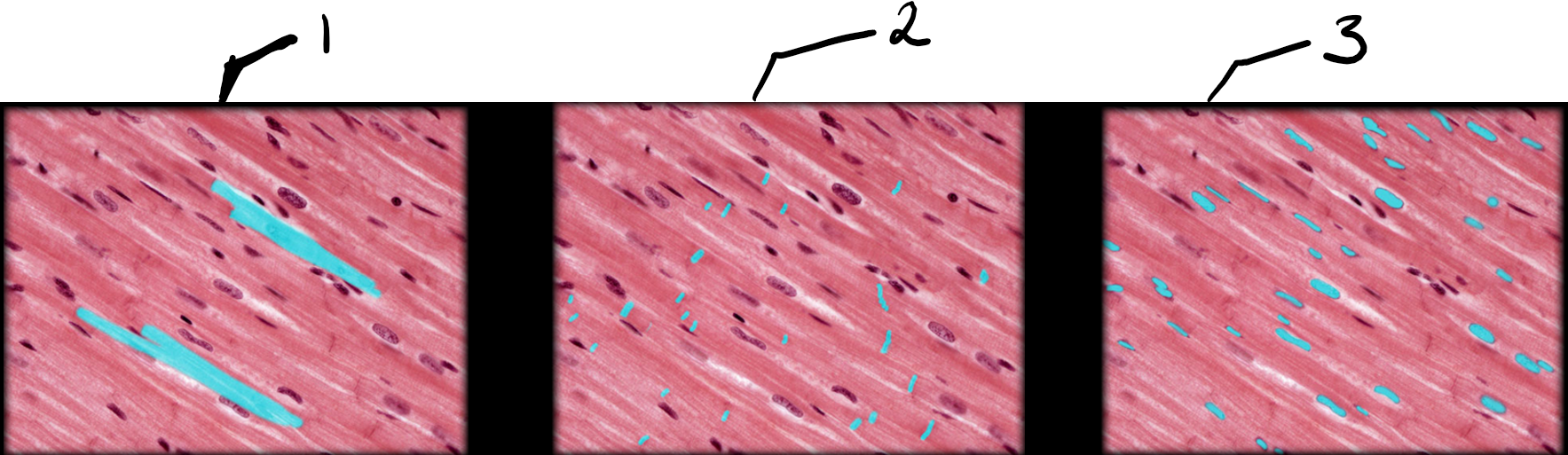 Cardiac Muscle