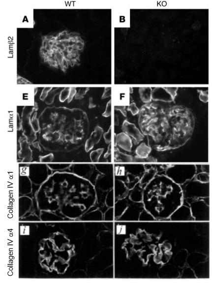 <ul><li><p>beta 2 deficiency GBM shows beta 1 chain expression</p></li><li><p>GBM contains wrong laminin isoform, can’t form effective filtration barrier </p></li><li><p>collagen IV not affected</p></li><li><p>laminin in glomerular BM doesn’t provide filtration barrier </p></li><li><p>need to be in right isoform to have functional filtration</p></li></ul><p></p>