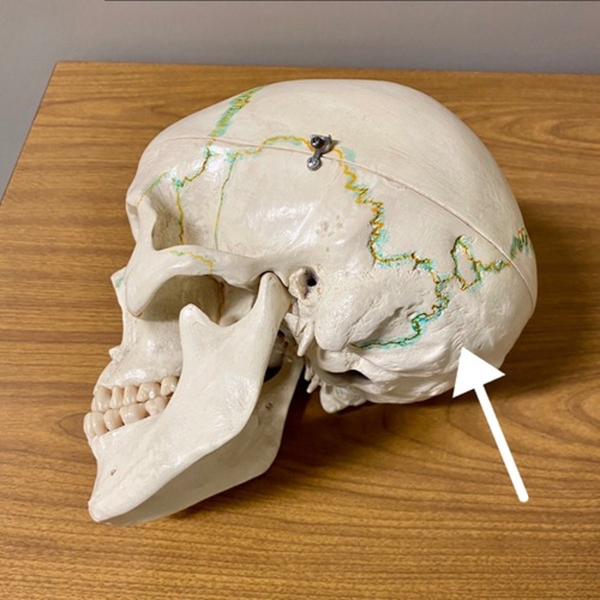 <p>What bone is this?</p>