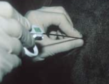 <p>-persistent increases in liver enzymes, chronic dz, poor treatment response, or suspect toxicity</p><p>-increased bile acids</p><p>-masses, infiltrate, abnormal size on ultrasound (except abscesses)</p>