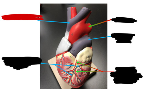 <p>Name this heart vessel</p>