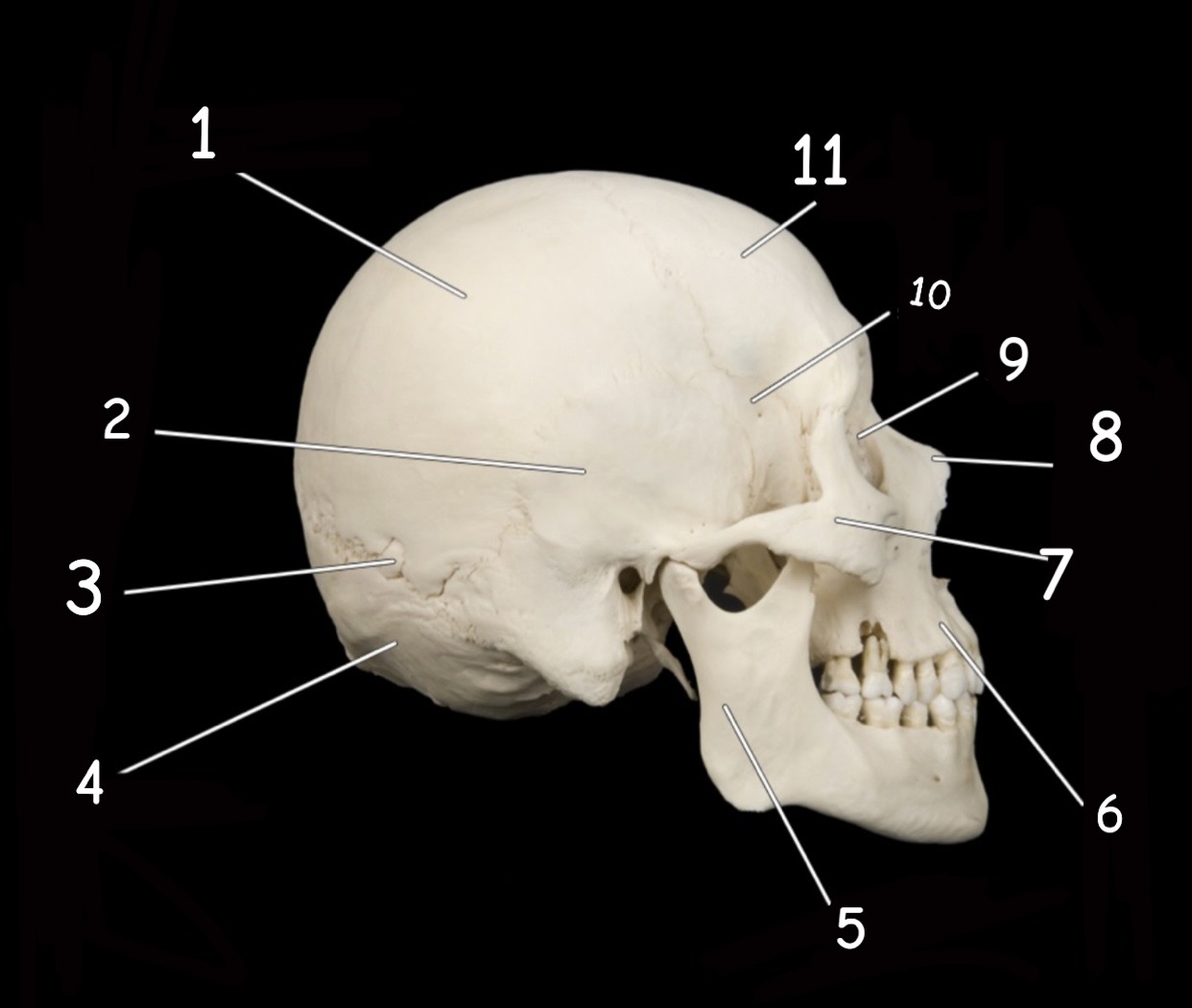 term image