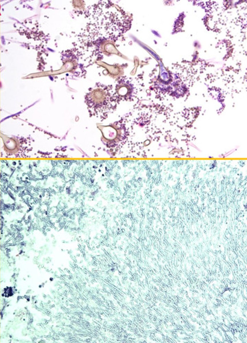 <p>Identify the organism?</p>