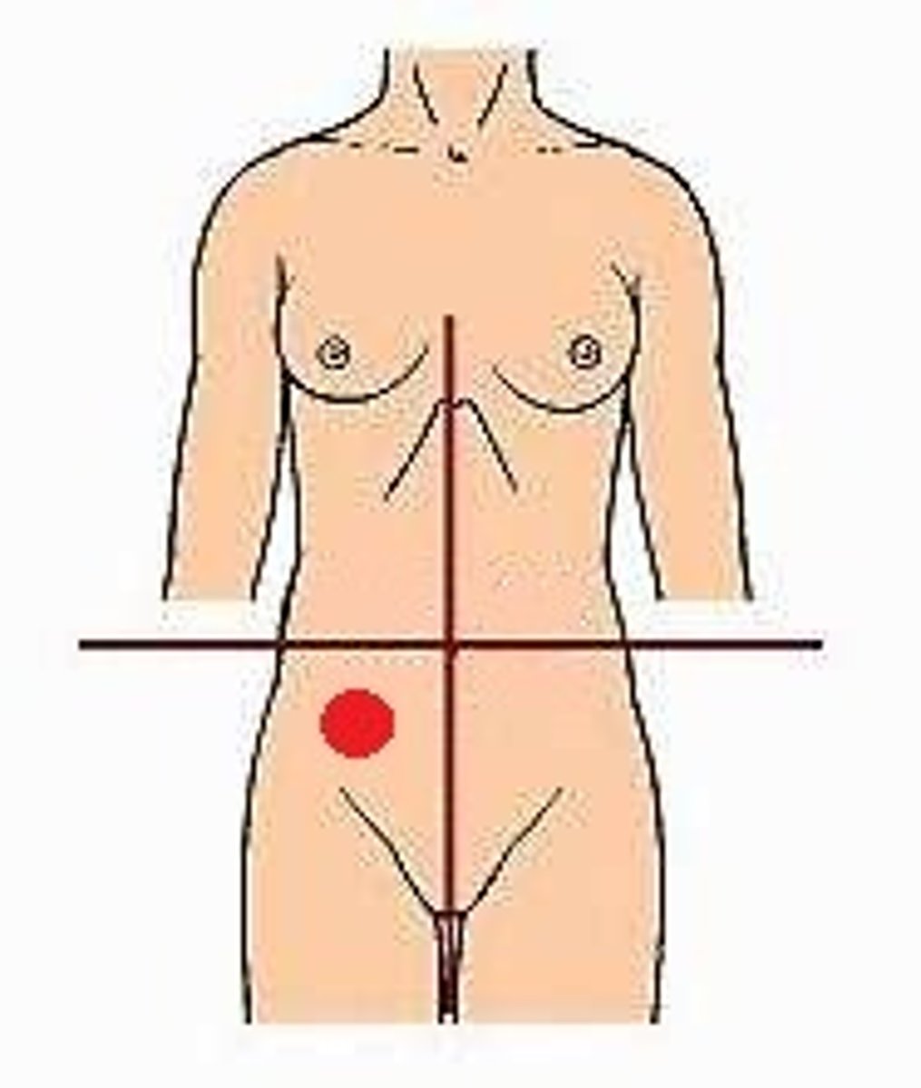 <p>Location:</p><p>Right of midline, inferior to transverse plane through umbilicus</p><p>Description:</p><p>Lower right lateral area of abdominopelvic cavity</p><p>Contents include parts of small intestine, large intestine (including cecum and vermiform appendix), urinary bladder (when distended), and right uterine tube and ovary</p>