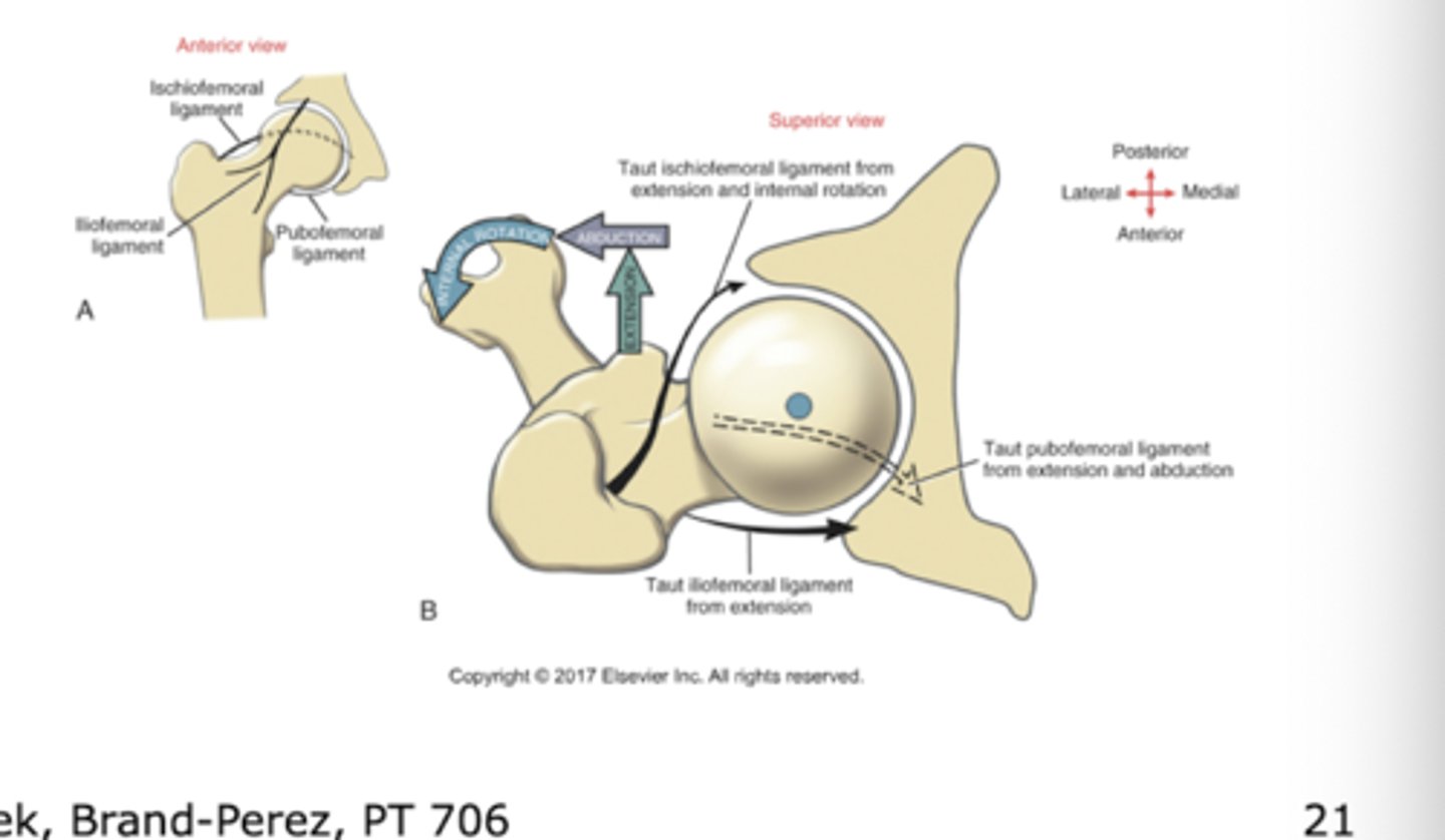 <p>internal rotation with extension, some abduction</p><p>* different than the most bony congruent position of the hip</p>