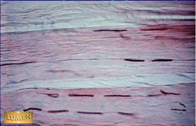 <p>This figure describes what?</p>