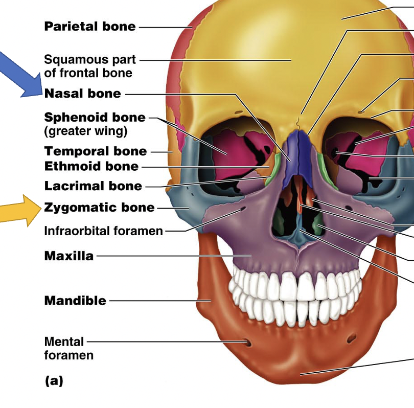 <p>Maxilla</p>