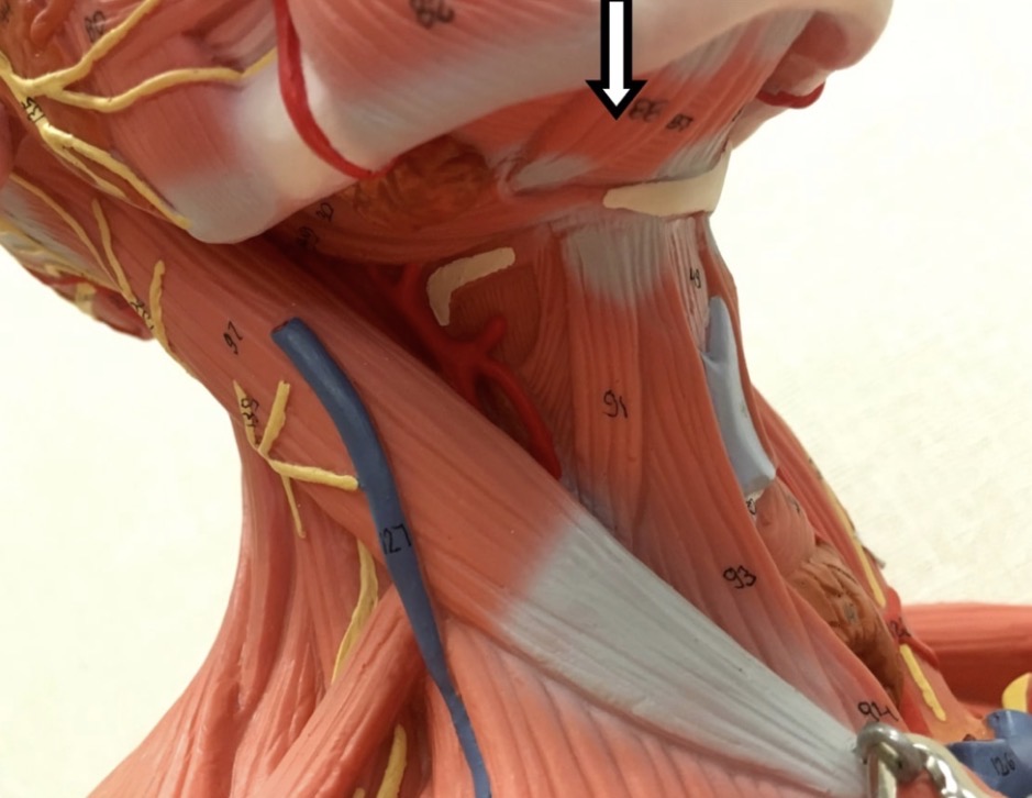 <p><span>Name the muscle labeled with the white arrow below:</span></p>