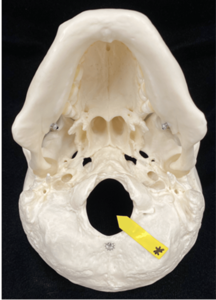 <p>name the bone and feature</p>