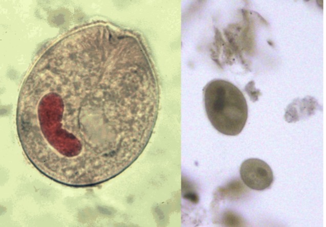 <p>Genus: Balantidium</p>