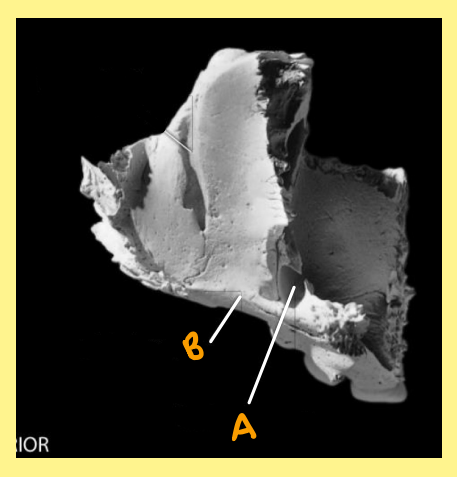 <p><u>Name the following</u>:</p><ul><li><p>Bone?</p></li><li><p>Side?</p></li><li><p>View?</p></li><li><p>B?</p></li></ul><p></p>