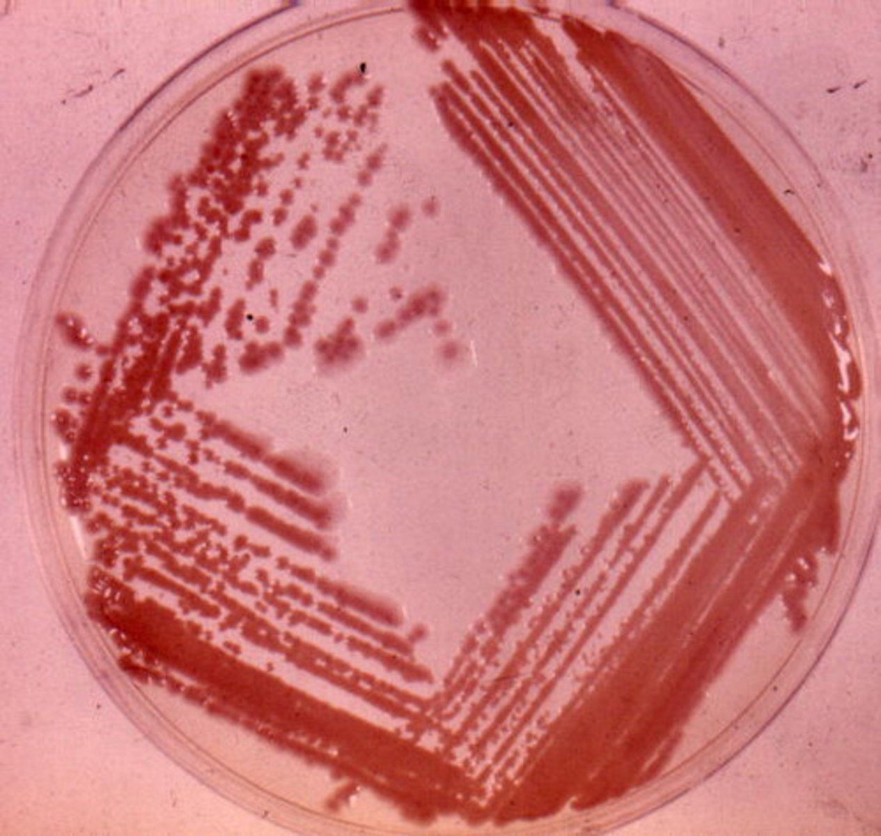 <p>Used to separate colonies of bacteria</p>