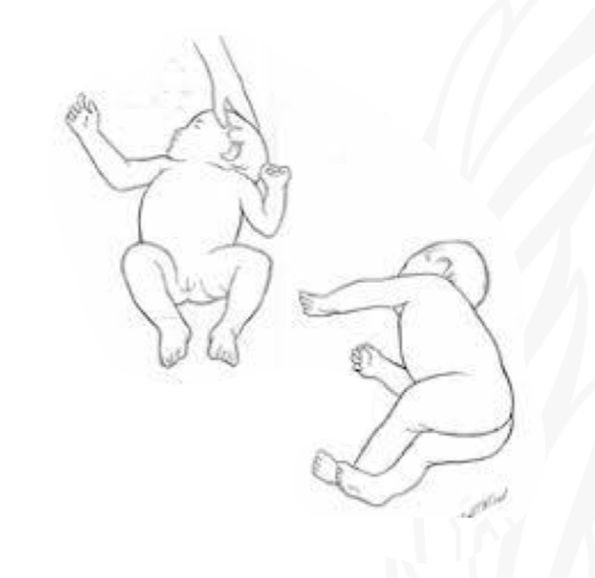 <p>Starting position</p>