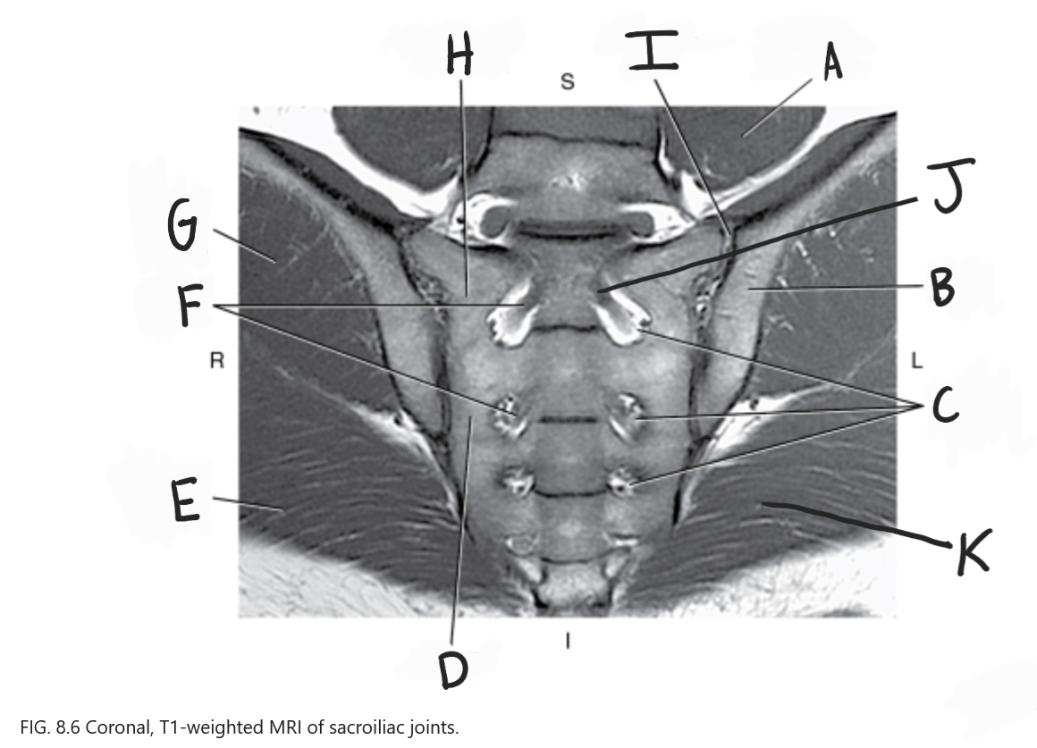 <p>What is E</p>
