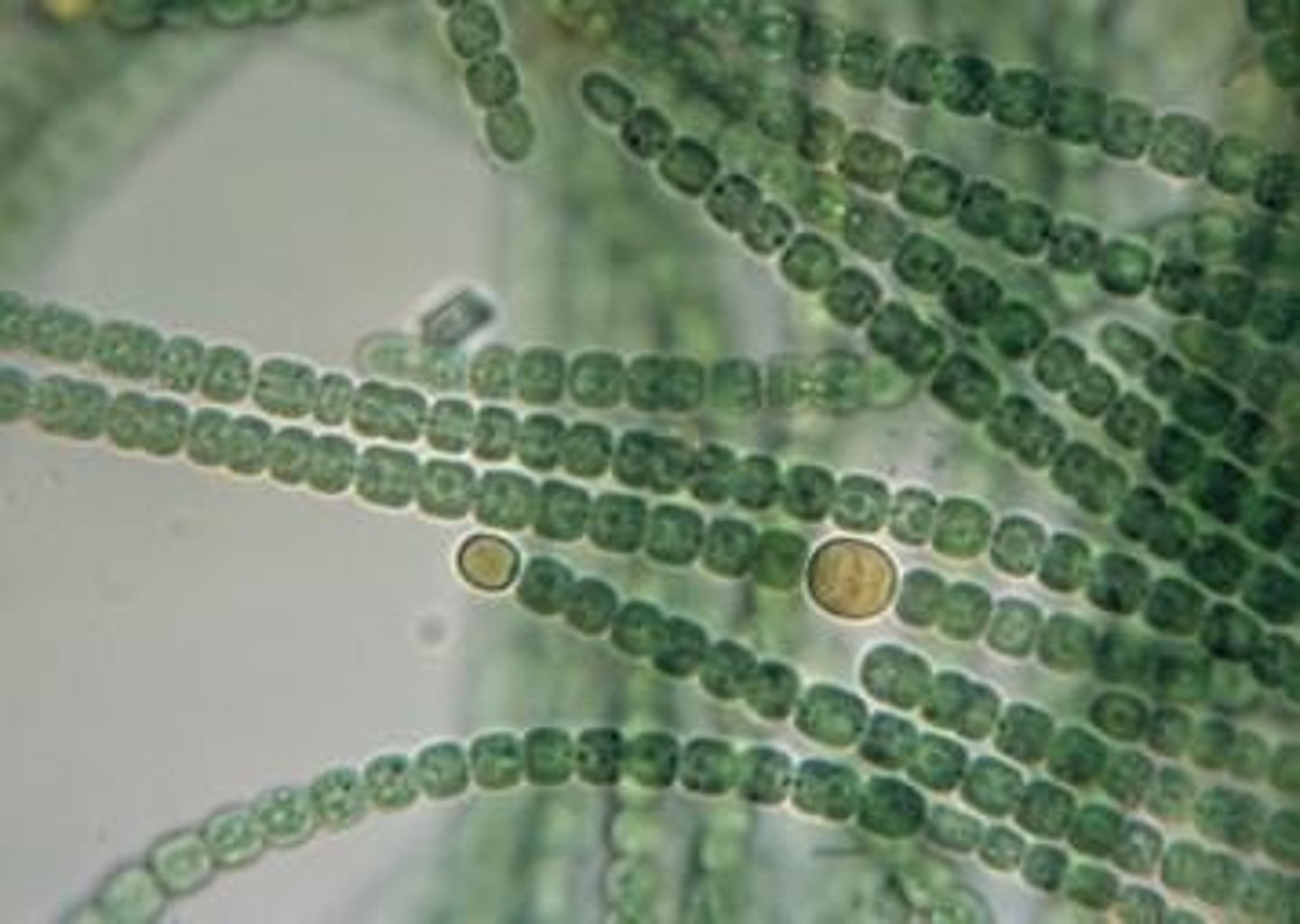 <p>Anabaena circinalis.</p>