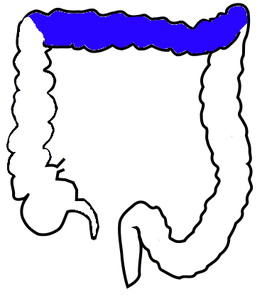 <p>The <strong><em><em></em></strong><strong><em></em></em></strong> is the part of the large intestine that runs horizontally across the abdomen, connecting the ascending colon to the descending colon.</p>