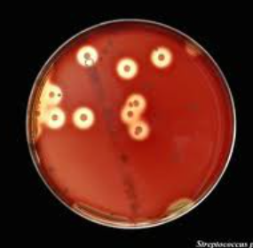 this activity produces the lysis of red blood cells in agar plate medium. Blood agar is prepared by mixing 5% sterile defibrinated sheep blood with a nutritional blood agar base that is cooled to 45C after autoclaving. Medium is dispensed into tubes or plates.
