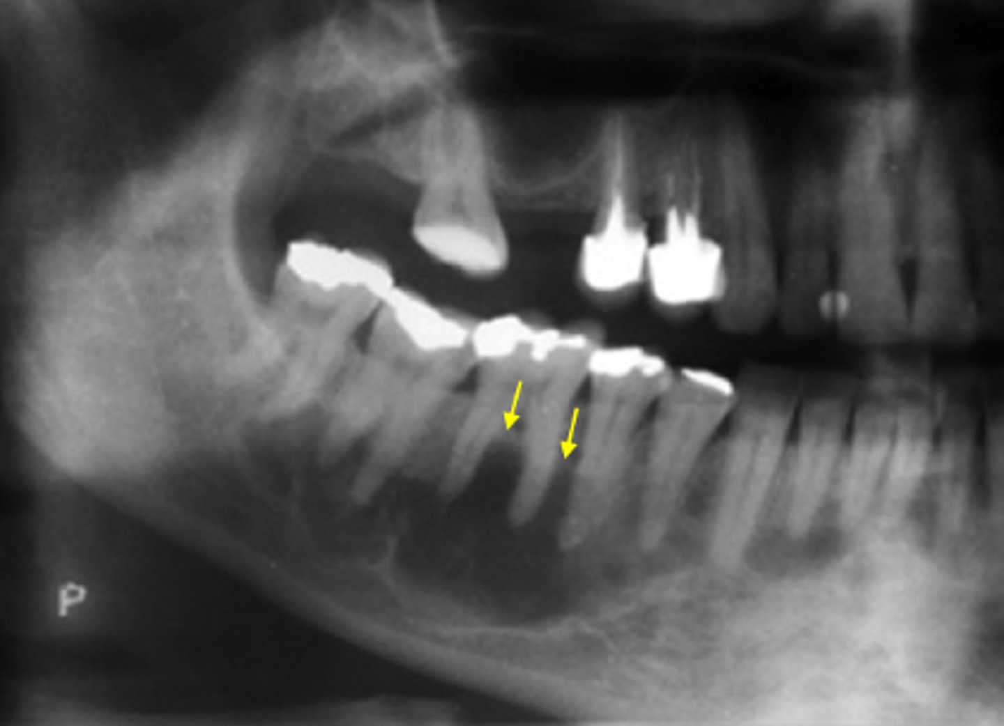 <p>ID the cyst:</p>