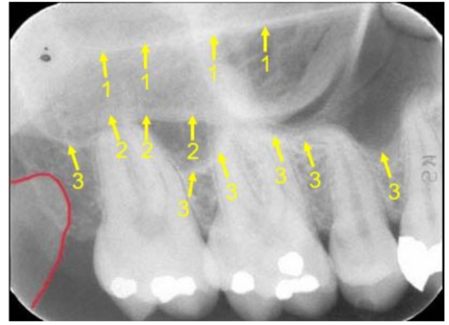 <p>Name the curved line scalloping between tooth roots labeled #3.</p>