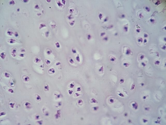 <p>Connective tissue: Hyaline cartilage</p>