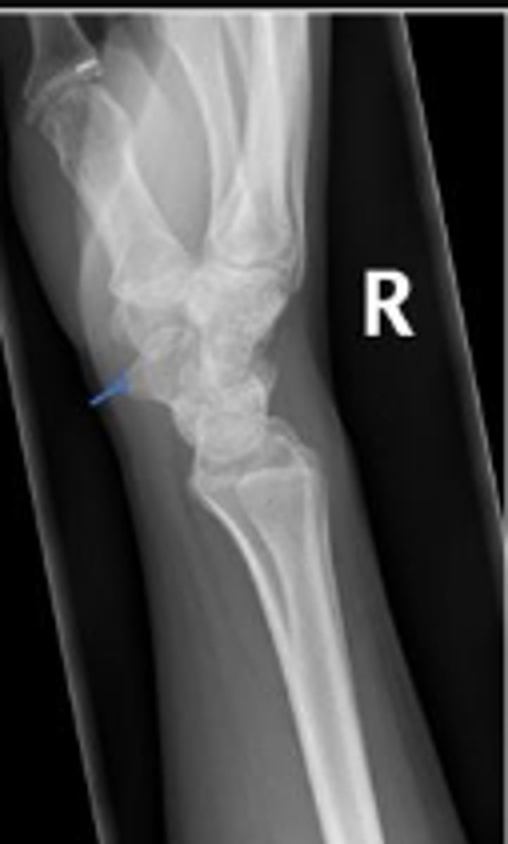 <p>What is the arrow pointing to?</p>