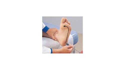 <p><span>If upon performing this test on an adult the toes are observed to flair this could indicate _____.</span></p>