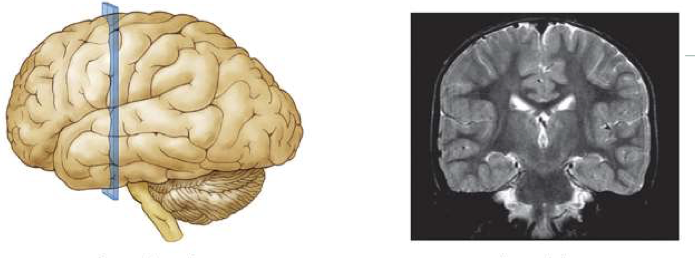 <p>What is this brain plane called? </p>