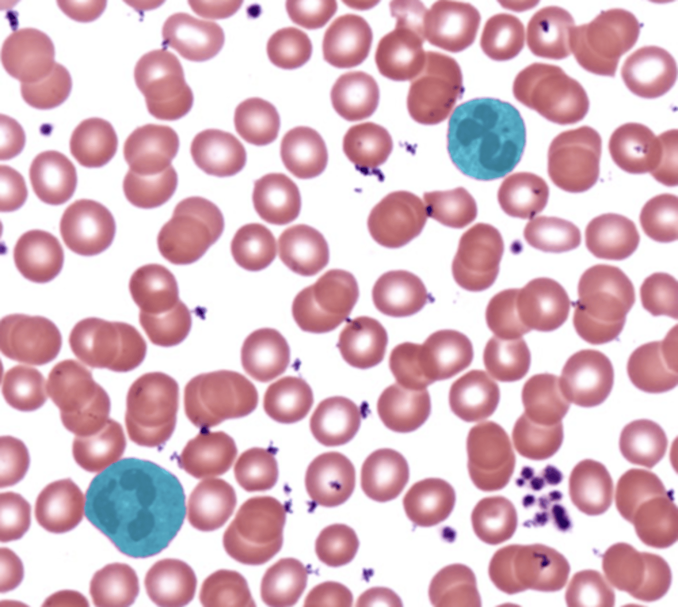 <p>- Leukocyte</p><p>- Multilobed nucleus</p><p>- Pale pink granules</p>
