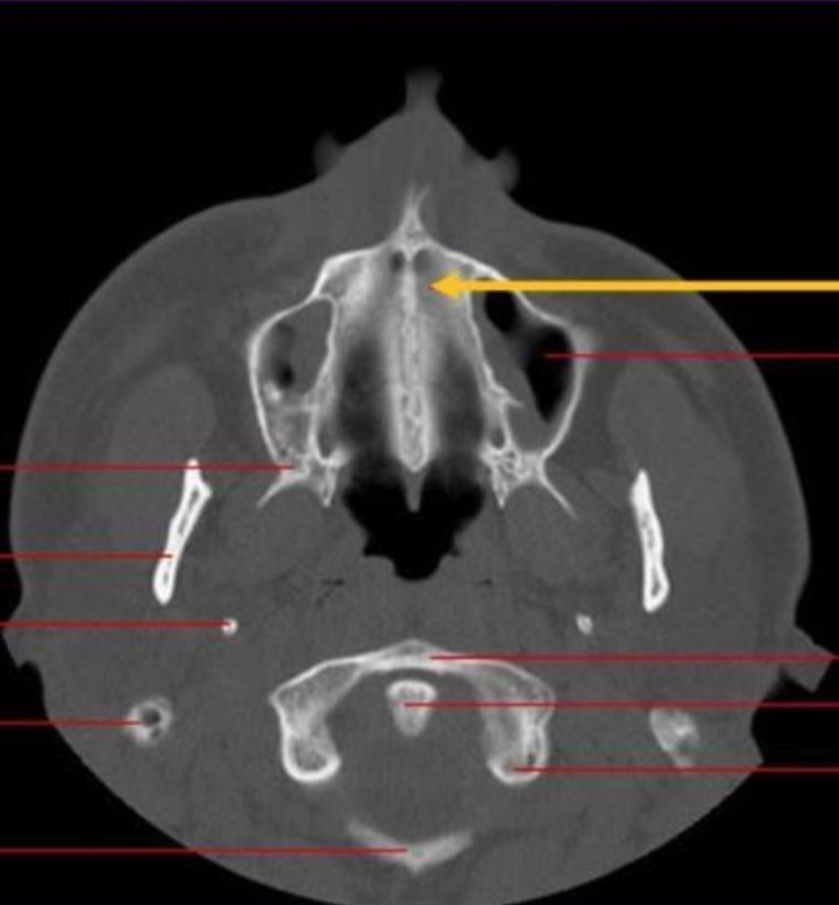 <p>identify the structure </p>