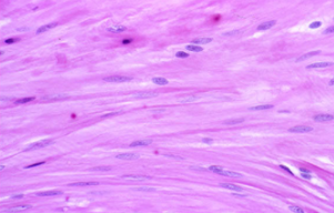 <p>Function: involuntary control - propels substances along redetermined pathways </p><p>Location: digestive, respiratory, and urinary tract - visceral muscles </p><p>Characteristics: lines hollow structures, smooth and no striations </p><ul><li><p>relatively short, fusiform cells</p></li><li><p>One centrally located nucleus </p></li></ul><p></p>