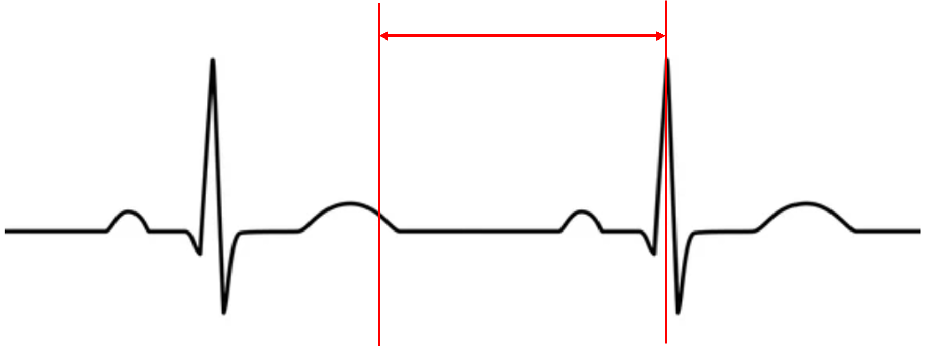 <p>what does this represent?</p>