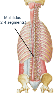 <p>transverse process below</p>