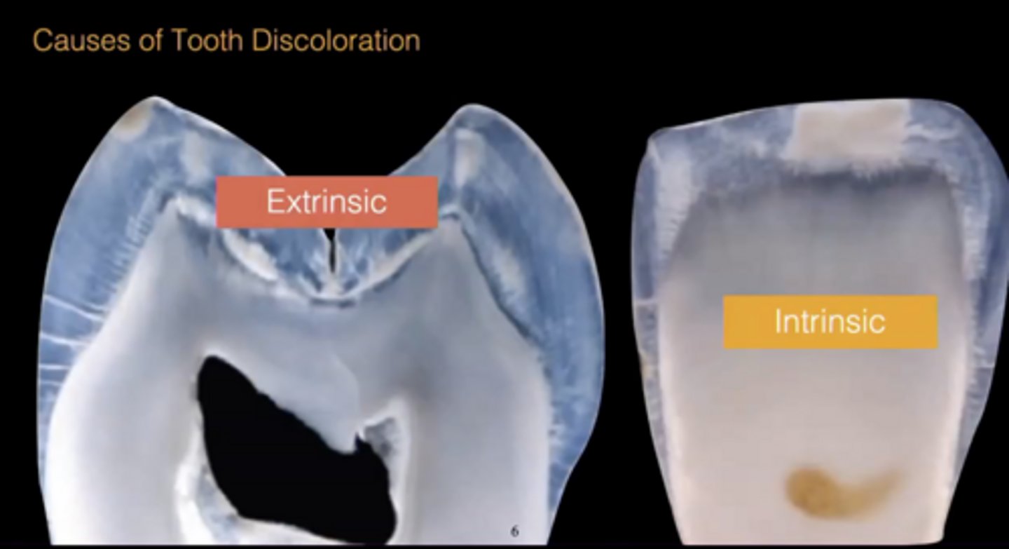 <p>Dentin</p>