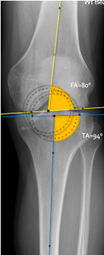 <p>Q what is the name of the bottom measurement? and what is the average + range?</p>