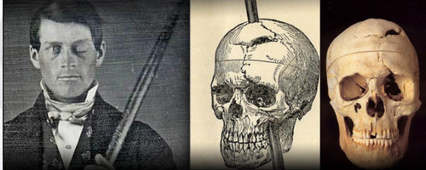 <p>had a railrod shot through his PFC &amp; eye which drastically changed his personality<br>- went from being very pleasant to loud, annoying, rude<br>- suggested that certain areas of the brain have to do with personality &amp; behavior</p>