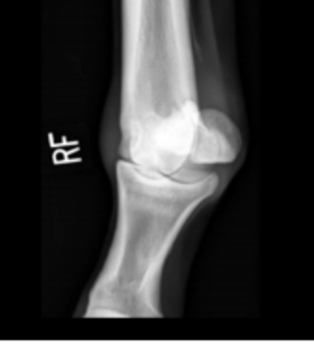 <p>Name the view and the anatomical region within the radiograph</p>