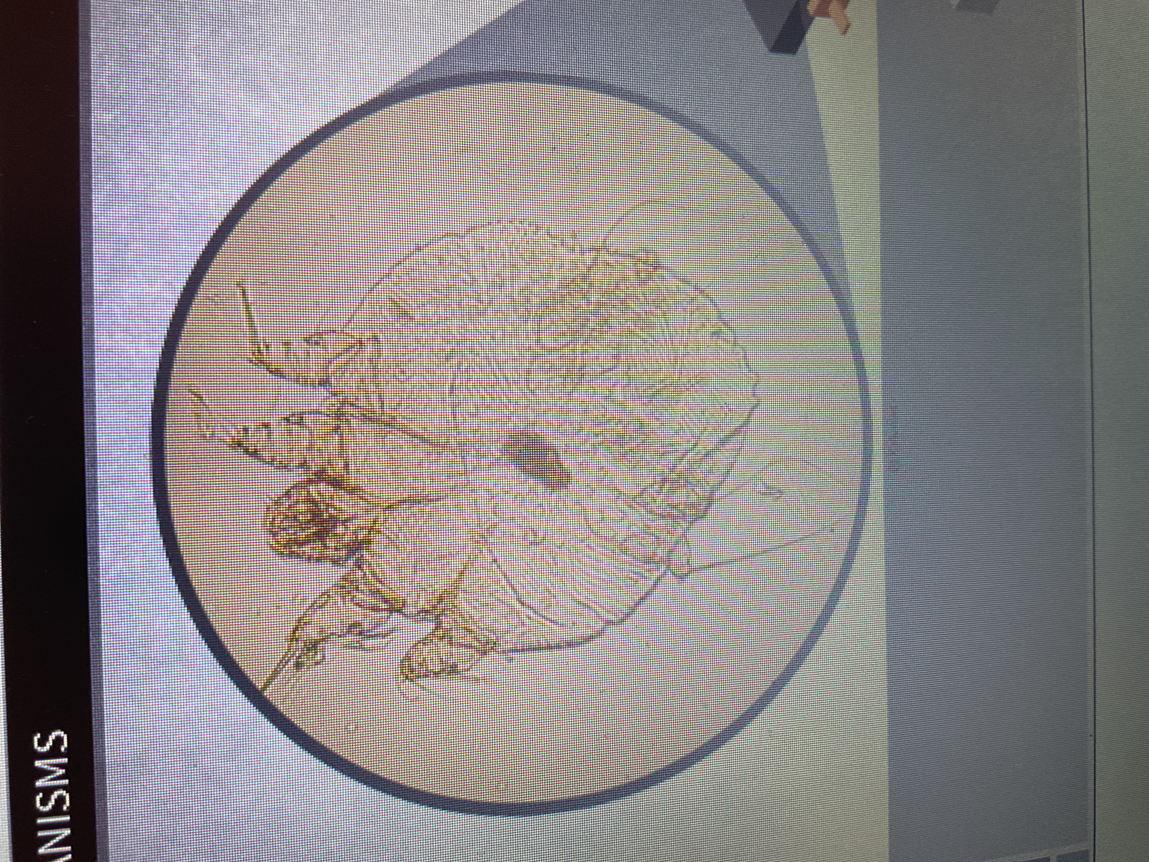 <p>Arthropod</p><p>scabies</p><p>burrows in the skin and lays eggs there</p>