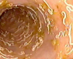 <p><span style="background-color: transparent;"><strong><span>Whipworms</span></strong></span></p>