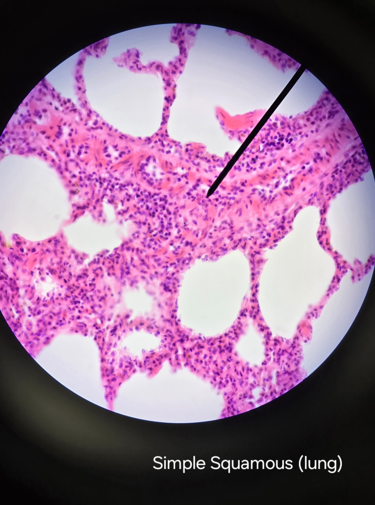 <p>Simple squamous epithelium</p>