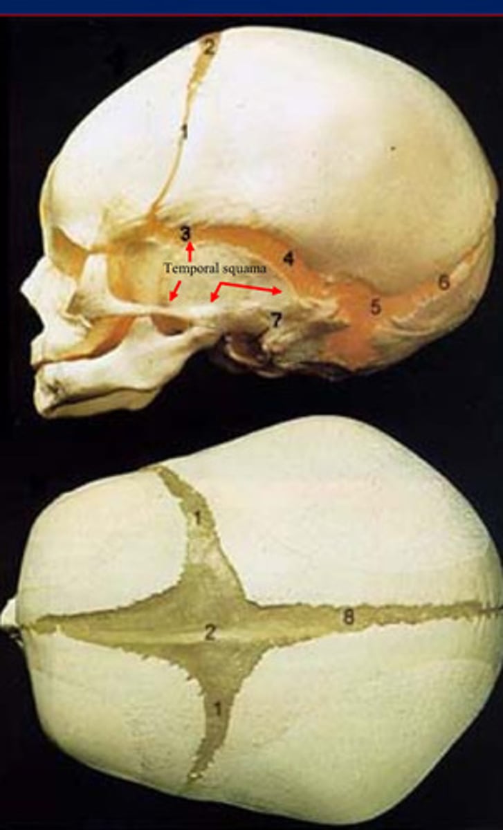 <p>Membranous neurocranium includes the ___ except temporal squama</p>