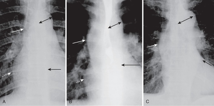 <p>Aortic Contours</p>