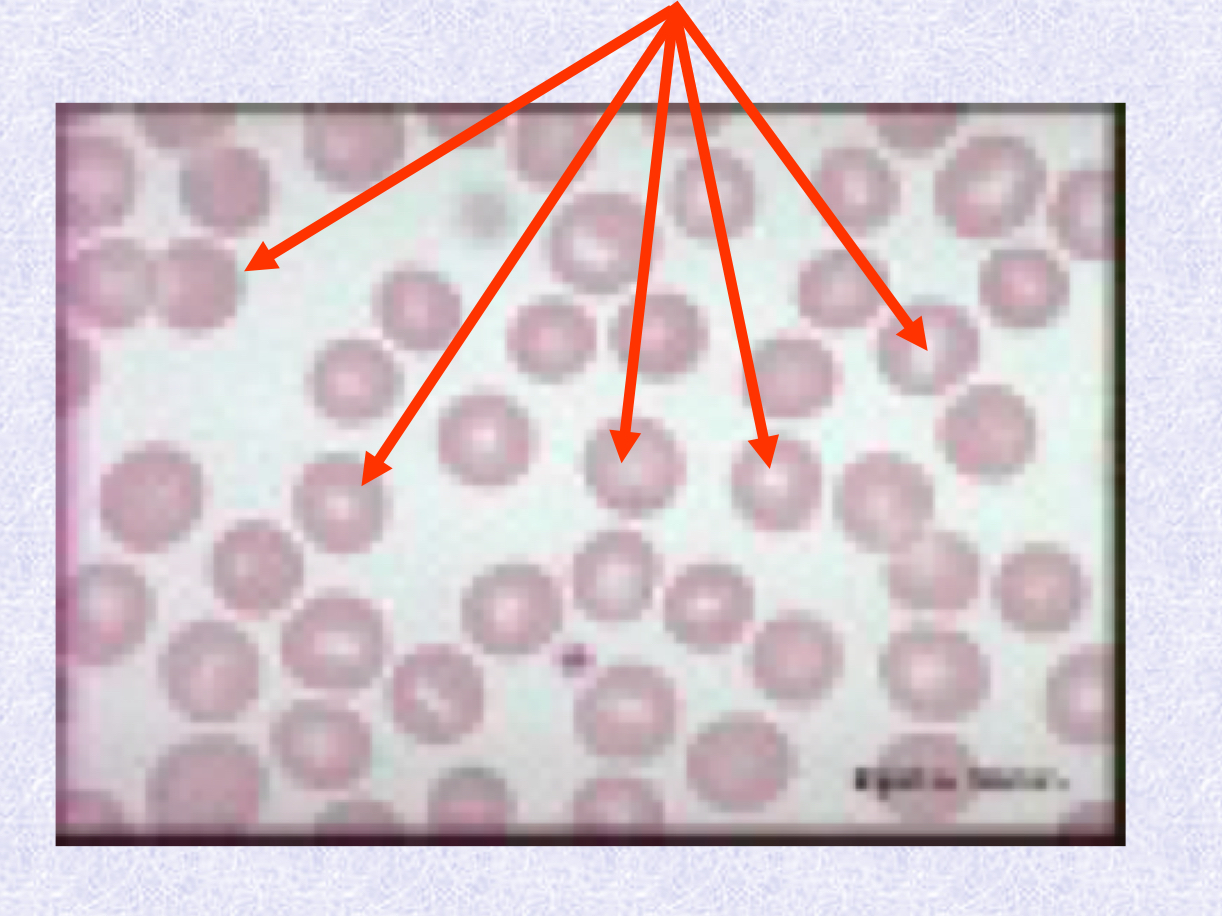 <p>What normoblastic maturation stage is in the image? Be specific</p>