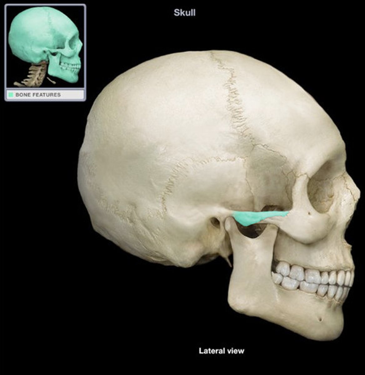 <p>temporal bone</p>
