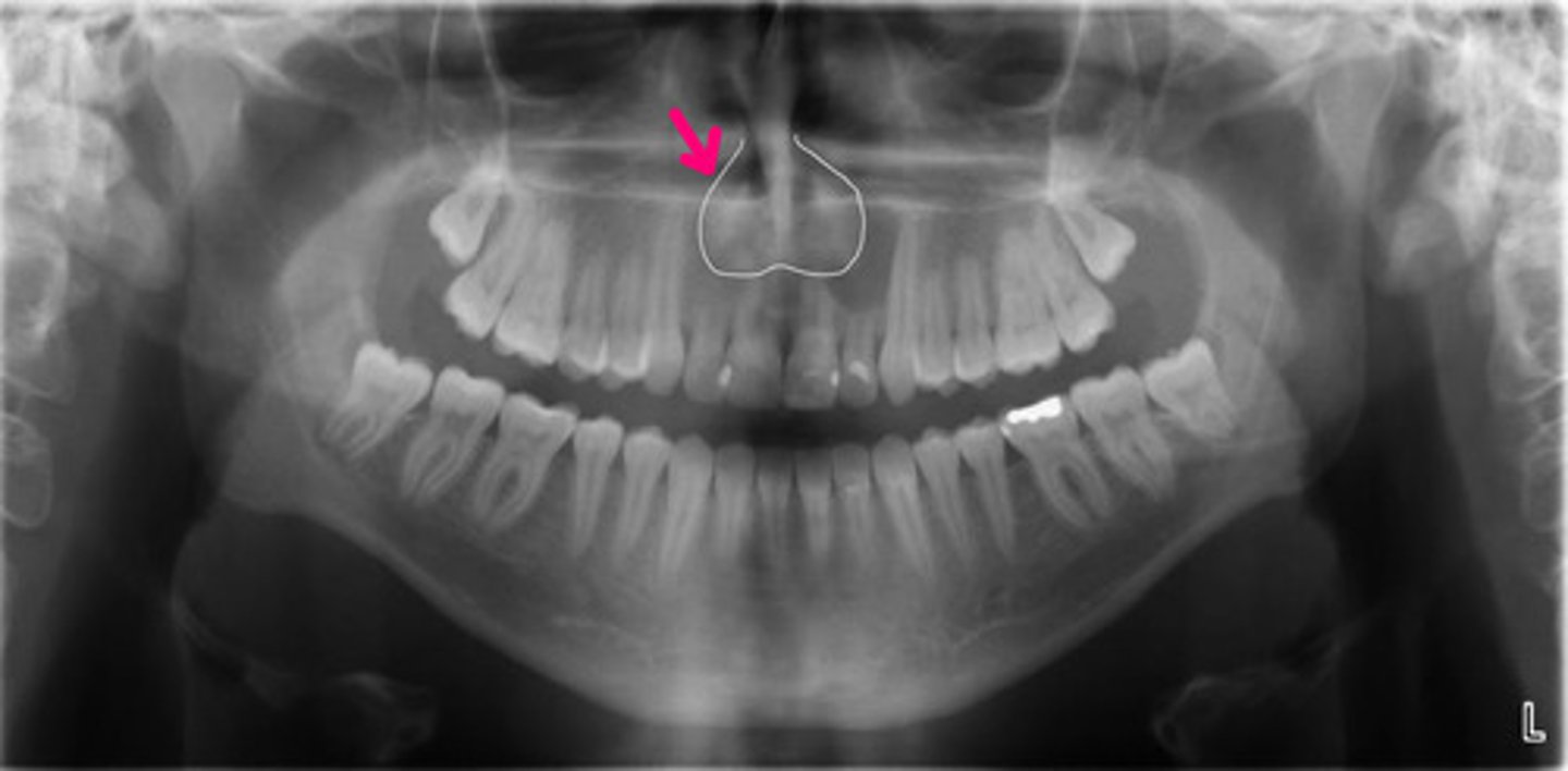 <p>Idenifty the midline structure.</p>