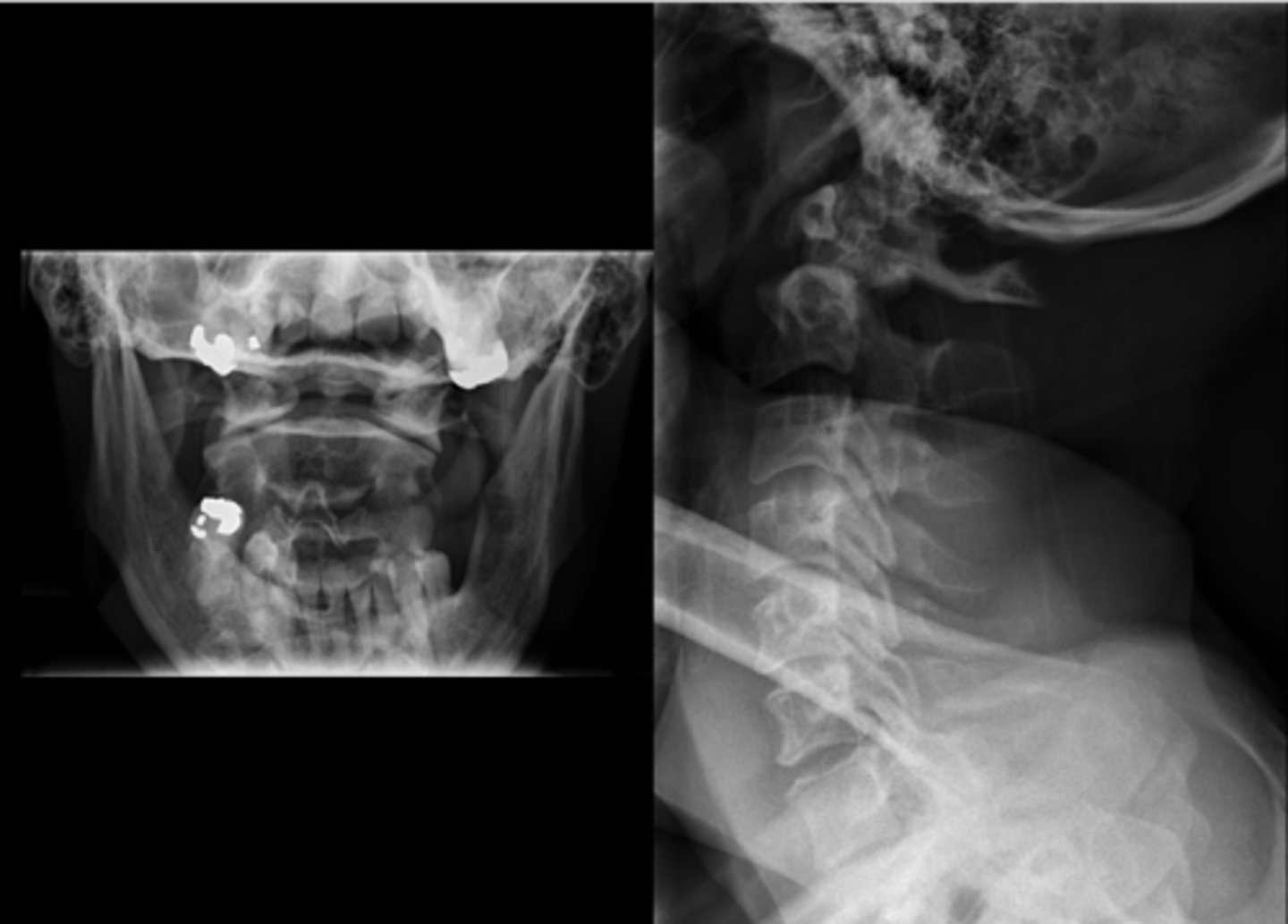 <p>Can you adjust this patient?</p>