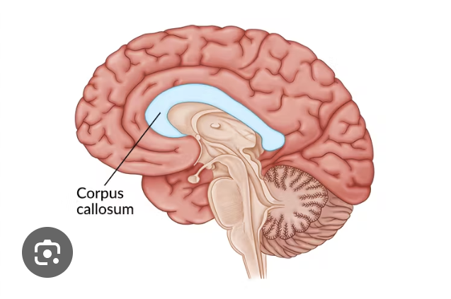 <p>it is a bundle of axons that connect the right and left cerebral hemispheres </p>