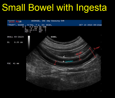 <p>Bowel diseases on Ultrasound</p>